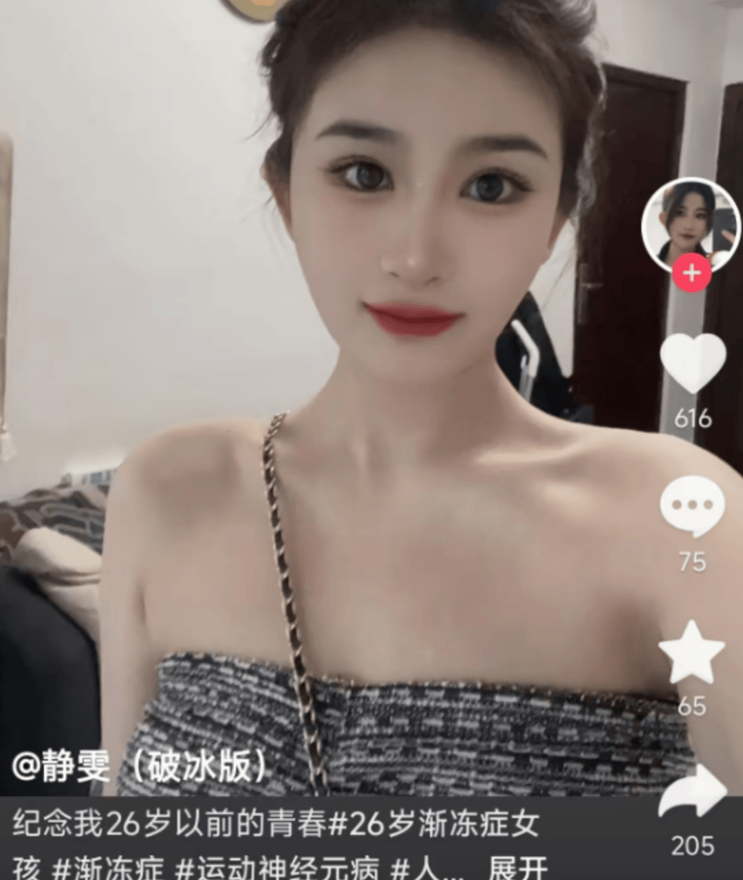 26歲漸凍癥女孩去世，生前曾向蔡磊求助，確診僅1年