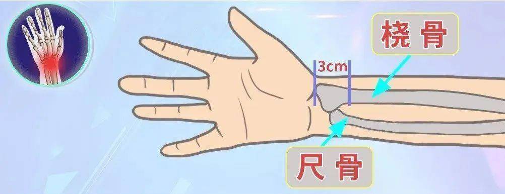 男子昏迷數(shù)日無人知竟是被卡在家中 居家意外傷害這樣防范